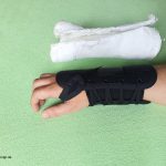 Gips - Orthese